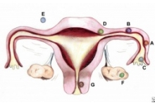 Признаки внематочной беременности